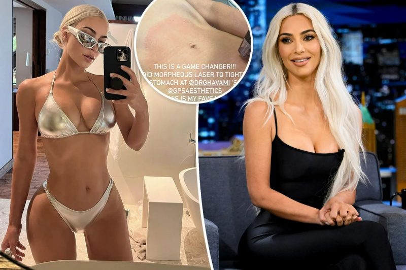 Kim Kardashian bekommt zum zweiten Mal eine hautstraffende Behandlung am Bauch